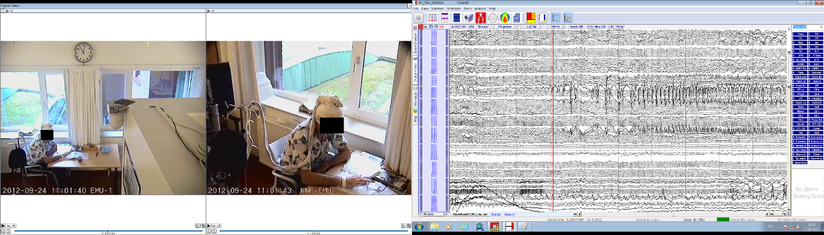 Dual-screenshot: 2 cameras on one screen, 128 channel EEG on second screen