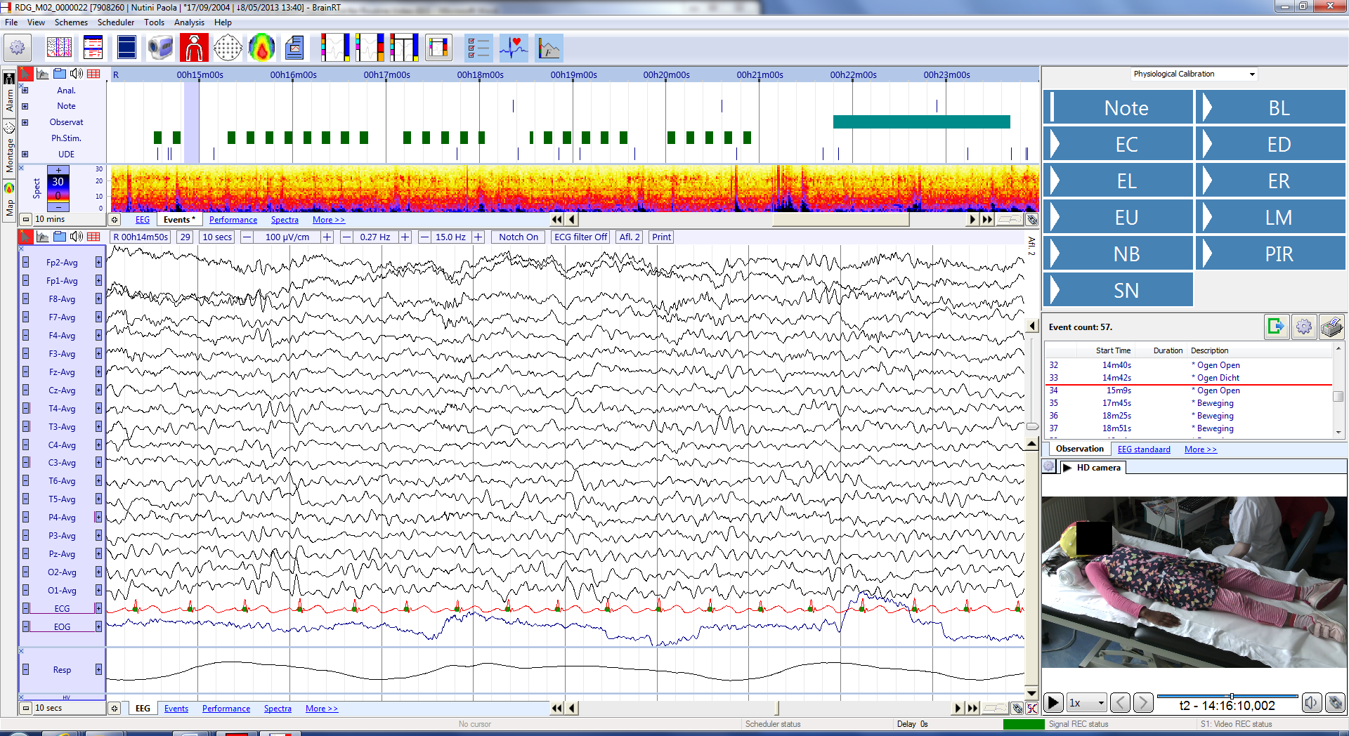 Example of a routine EEG with HD video