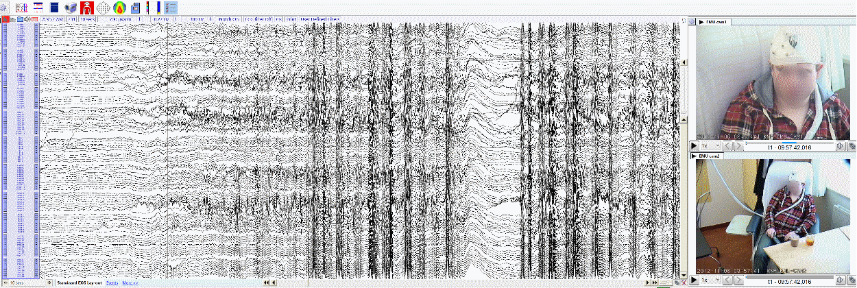 EEG analysis image